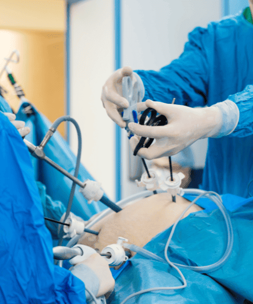 Laparoscopic surgery