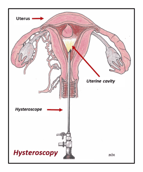 Minimally Invasive Surgery